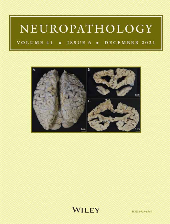 Japanese Society of Neuropathology Award 2021