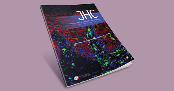Relationship of Notch Signal, Surfactant Protein A, and Indomethacin in Cervix During Preterm Birth: Mast Cell and Jagged-2 May Be Key in Understanding Infection-mediated Preterm Birth