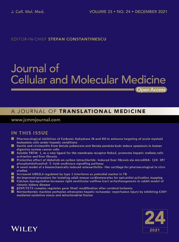 SDF‐1 inhibits the dedifferentiation of islet β cells in hyperglycaemia by up‐regulating FoxO1 via binding to CXCR4