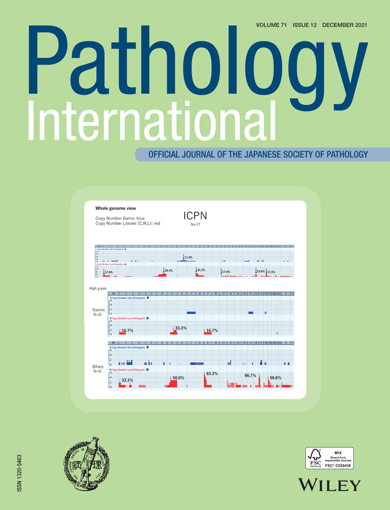 Congenital tracheo‐esophageal transition: A previously undescribed tracheo‐esophageal malformation that showed direct transition of the trachea to the esophagus