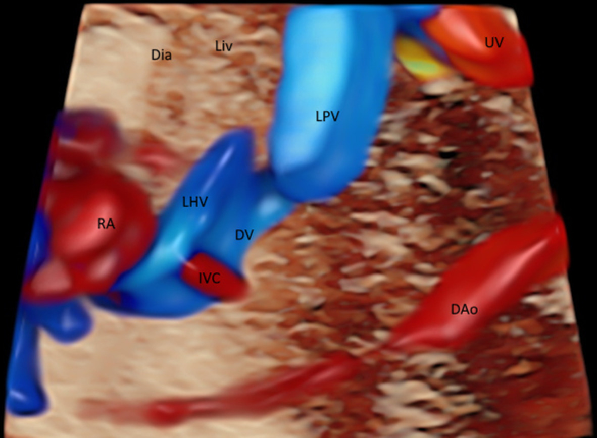 Imaging of fetal precordial venous system by four‐dimensional ultrasound with spatiotemporal image correlation technology
