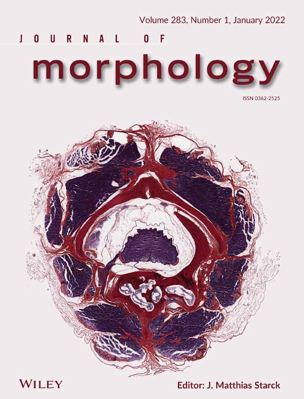 Gonad morphology of Rhyacichthys aspro (Valenciennes, 1837), and the diagnostic reproductive morphology of gobioid fishes
