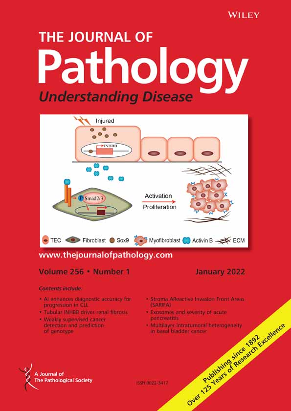 Widespread in situ follicular neoplasia in patients who subsequently developed follicular lymphoma