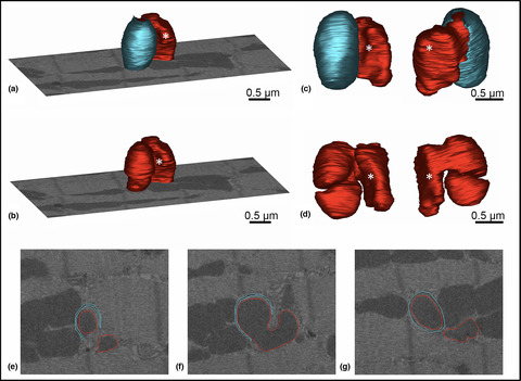 Spermidine supplementation influences mitochondrial number and morphology in the heart of aged mice