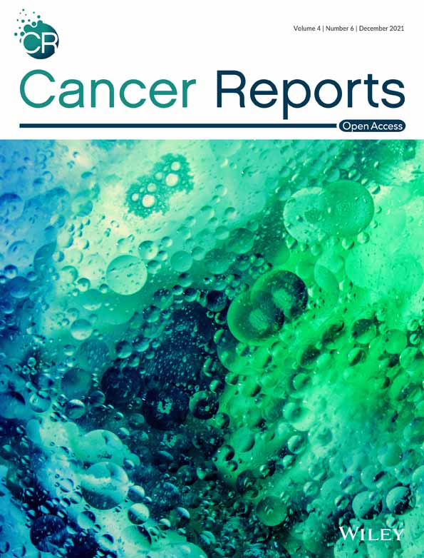Can the predictive value of multiparametric MRI for prostate cancer be improved by a liquid biopsy with SelectMDx?