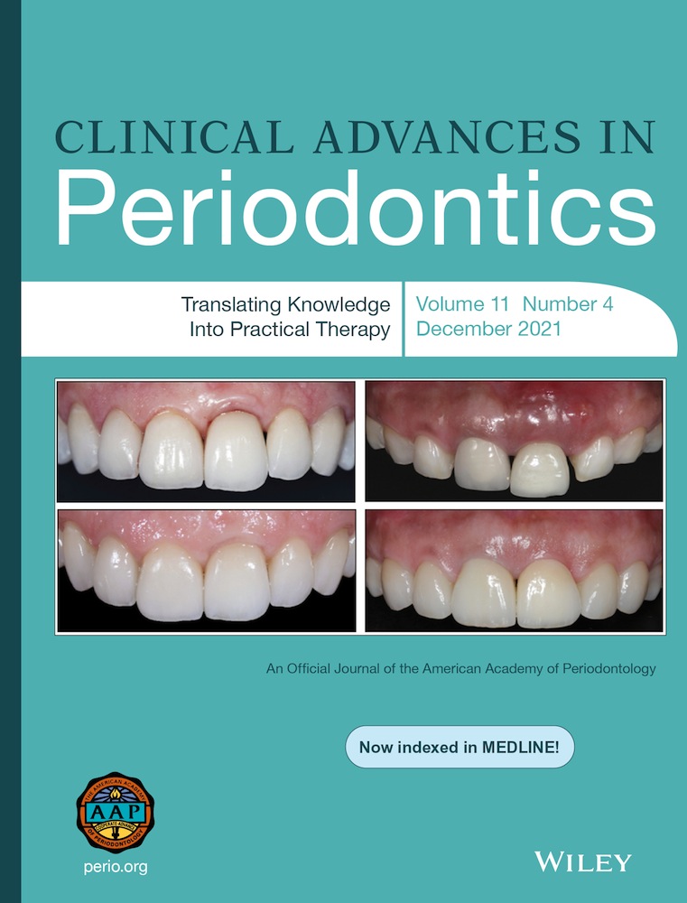 Rehabilitation Challenge in Patient With a High Smile Line: Case Report and Review of Surgical Protocols