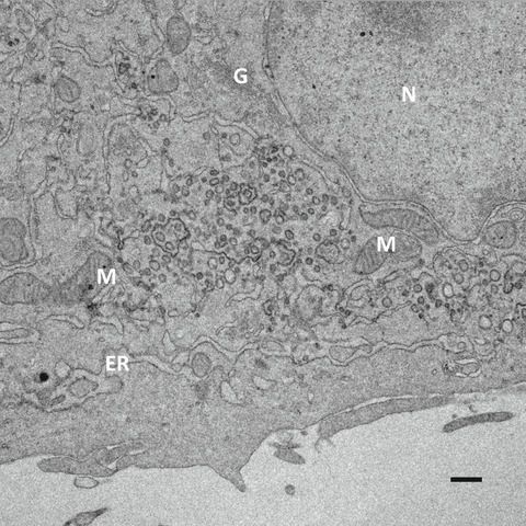 Architecture of torovirus replicative organelles