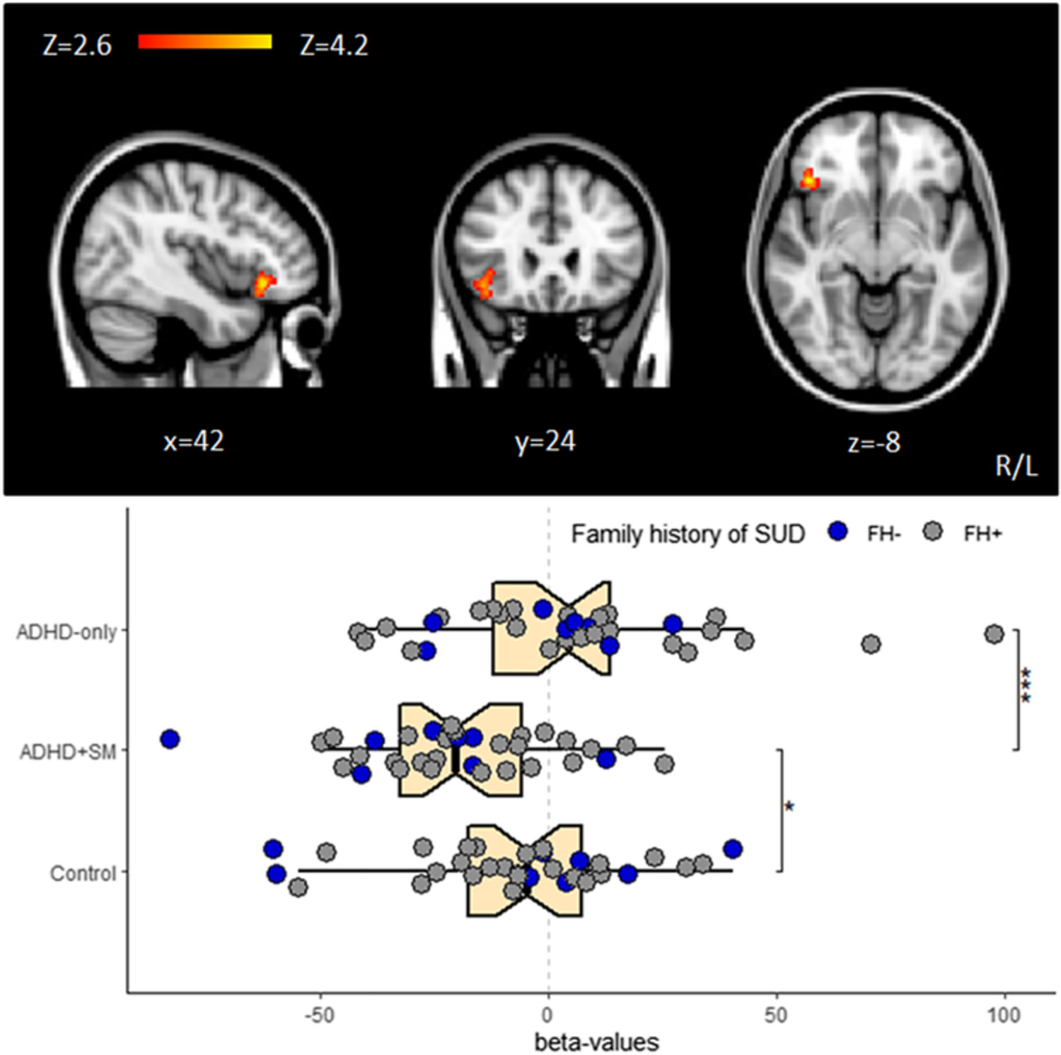 Effects of substance misuse on inhibitory control in patients with attention‐deficit/hyperactivity disorder