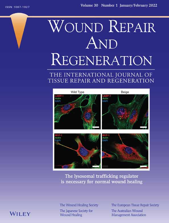 Phenotypic characterisation and associations of leg ulcers in adult sickle cell patients