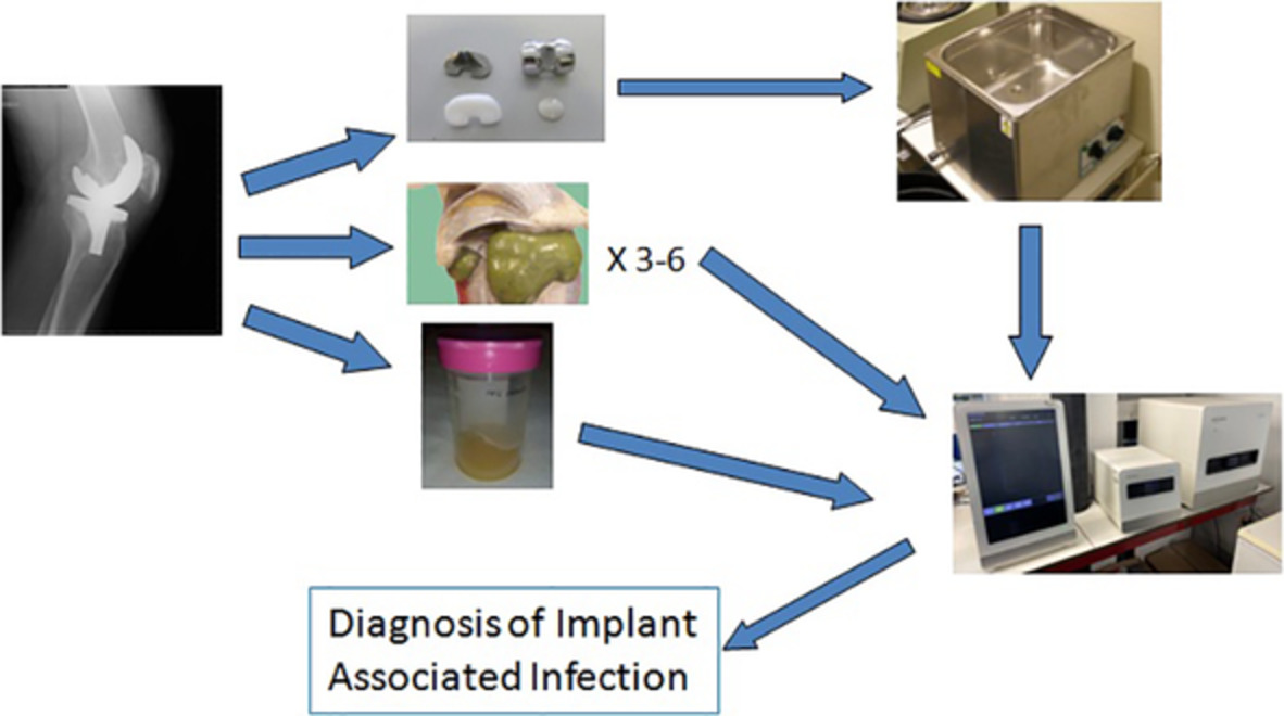 Usefulness of a Multiplex PCR Assay for the Diagnosis of Prosthetic Joint Infections in the Routine Setting