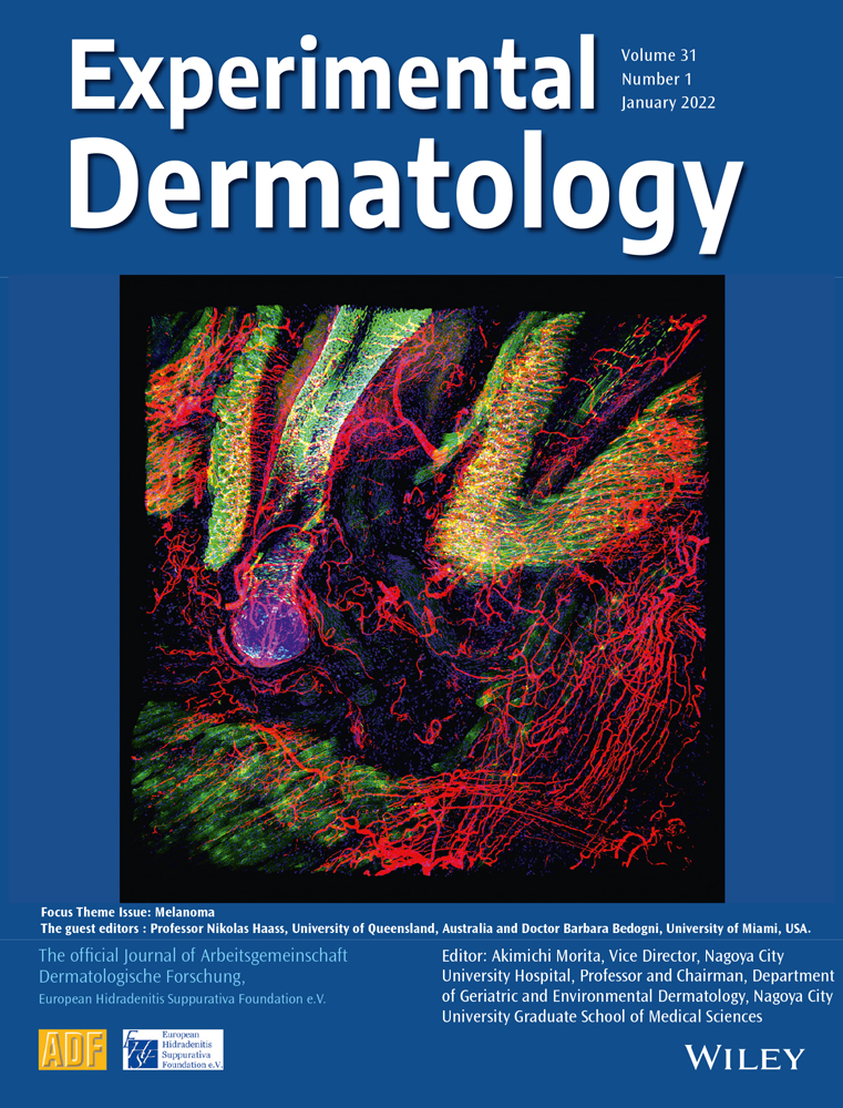 BRN2 and MITF together impact AXL expression in melanoma