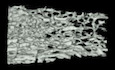 Myeloid‐derived growth factor (MYDGF) protects bone mass through inhibiting osteoclastogenesis and promoting osteoblast differentiation