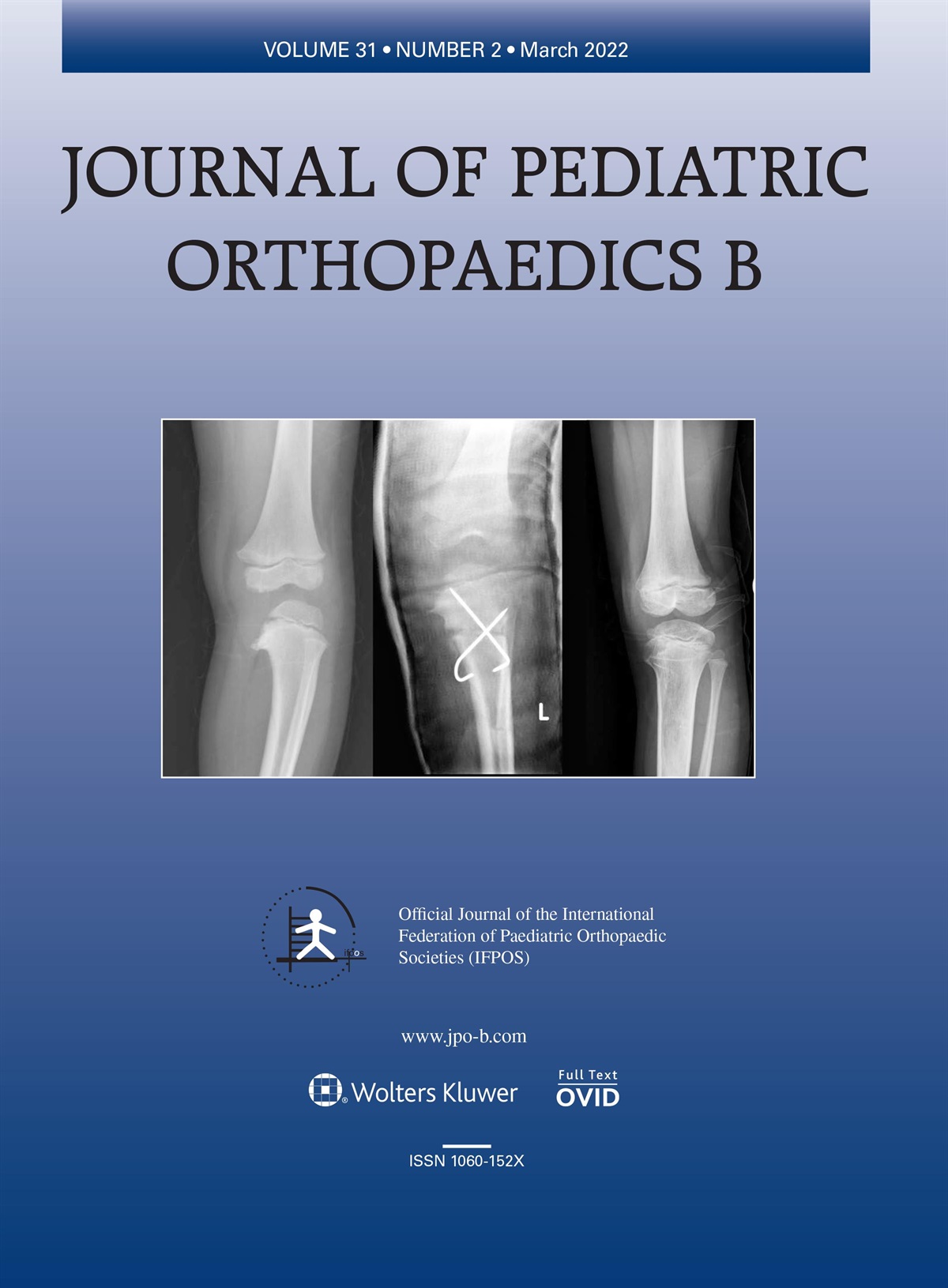 Vitamin-D level, body mass index and fracture risk in children: vitamin-D deficiency and fracture risk. Varkal MA, Gulenc B, Yildiz I, Kandemir I, Bilgili F, Toprak S, et al. J Pediatr Orthop B 2022; 31:e264–e270