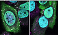 Disease‐linked TDP‐43 hyperphosphorylation suppresses TDP‐43 condensation and aggregation