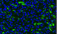 AKT2 reduces IFNβ1 production to modulate antiviral responses and systemic lupus erythematosus