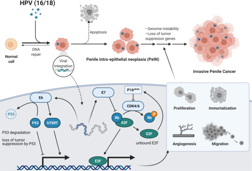 The Evolving Landscape of Viral, Immune, and Molecular Biomarkers in Penile Cancer