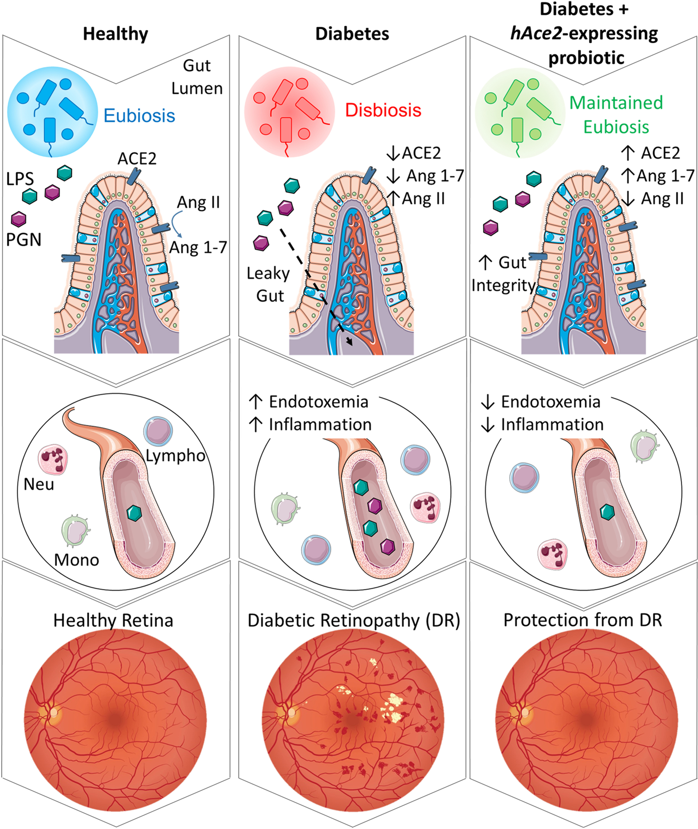 Maintenance of Enteral ACE2 Prevents Diabetic Retinopathy in Type 1 Diabetes