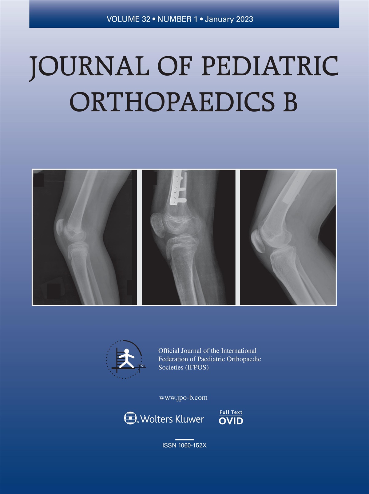 Age in pediatric flexible flatfoot: what do we know?