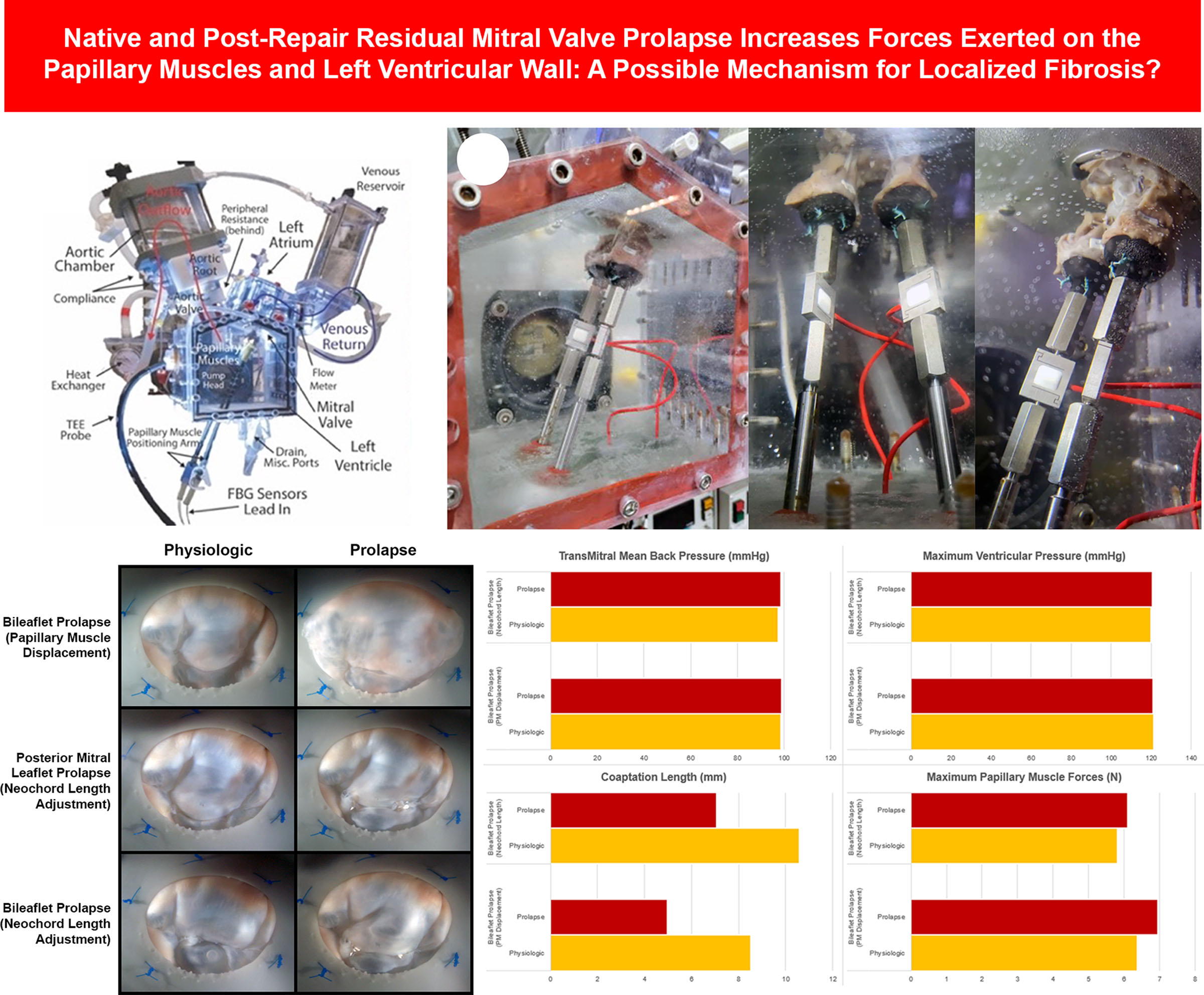 Native and Post-Repair Residual Mitral Valve Prolapse Increases Forces Exerted on the Papillary Muscles: A Possible Mechanism for Localized Fibrosis?