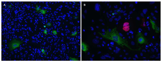 Viruses, Vol. 15, Pages 89: Should SVGp12 Be Used for JC Polyomavirus Studies? Comment on Prezioso et al. COS-7 and SVGp12 Cellular Models to Study JCPyV Replication and MicroRNA Expression after Infection with Archetypal and Rearranged-NCCR Viral Strains. Viruses 2022, 14, 2070