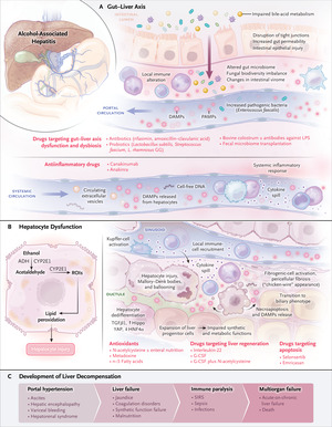 Alcohol-Associated Hepatitis
