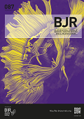 Measuring reader fatigue in the interpretation of screening digital breast tomosynthesis (DBT)