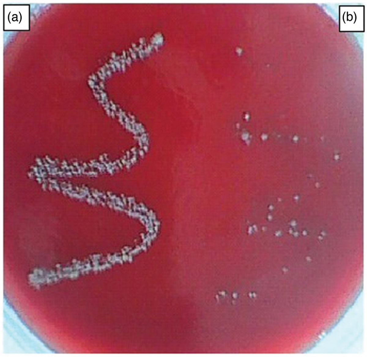 Quantitative and qualitative profile of aerobic bacteria in the second mandibular molar free of caries and caries, based on a case–control study