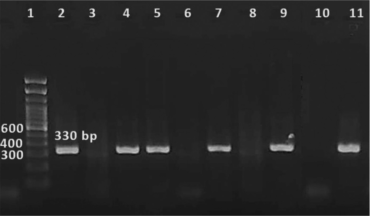 Human adenovirus 6 identification in tonsillar tissue of children with tonsillar hypertrophy