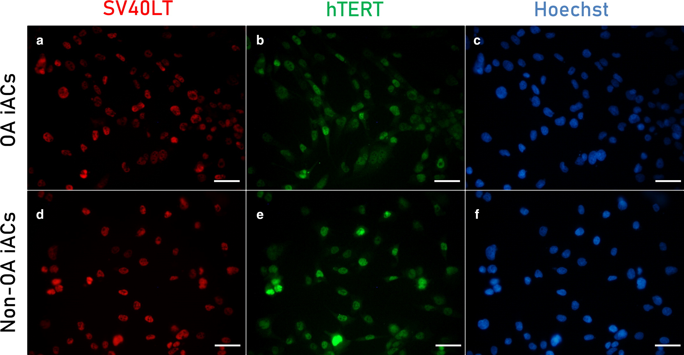 Generation of human immortalized chondrocytes from osteoarthritic and healthy cartilage