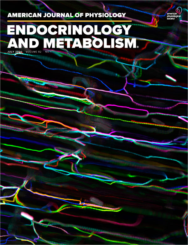Human pancreatic capillaries and nerve fibers persist in type 1 diabetes despite beta cell loss