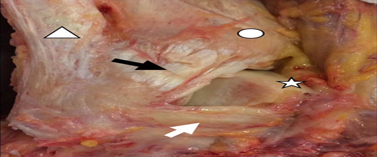 High Ankle Syndesmosis Disruption: All-Inside Arthroscopic Reduction and Internal Fixation