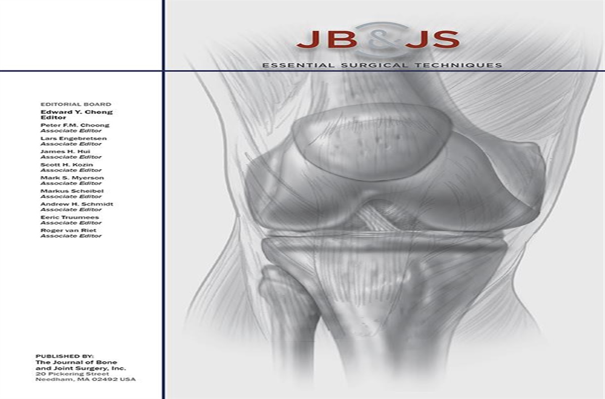 Hammer Toe Correction with Proximal Interphalangeal Joint Arthrodesis