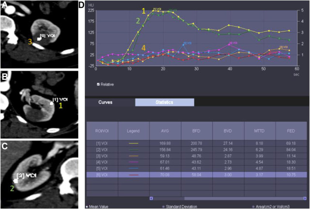 Radiologist’s Disease