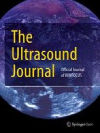 Femoral vein pulsatility: a simple tool for venous congestion assessment