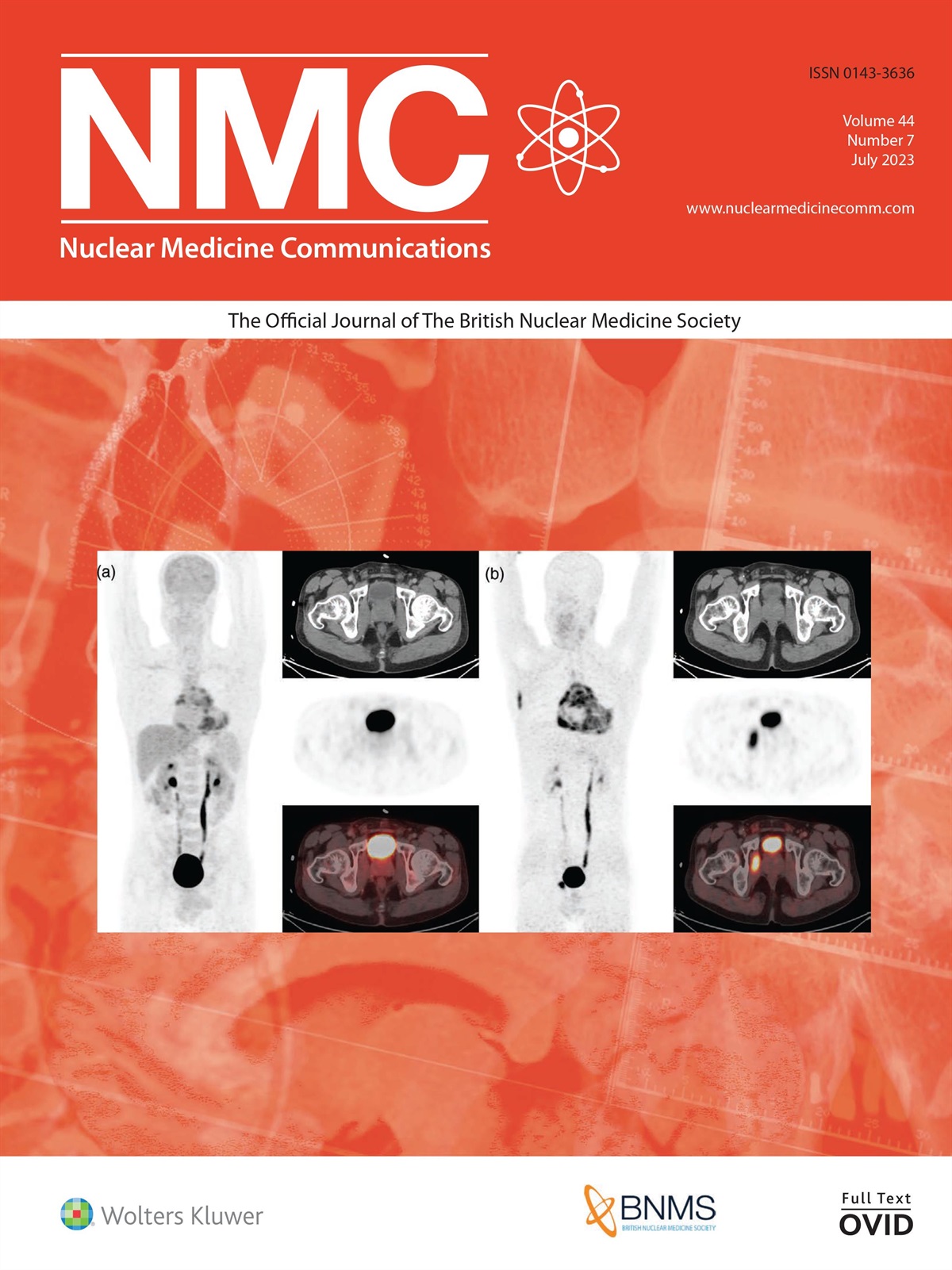 Parametric mapping for 11C-metomidate PET-computed tomography imaging in the study of primary aldosteronism: Retraction