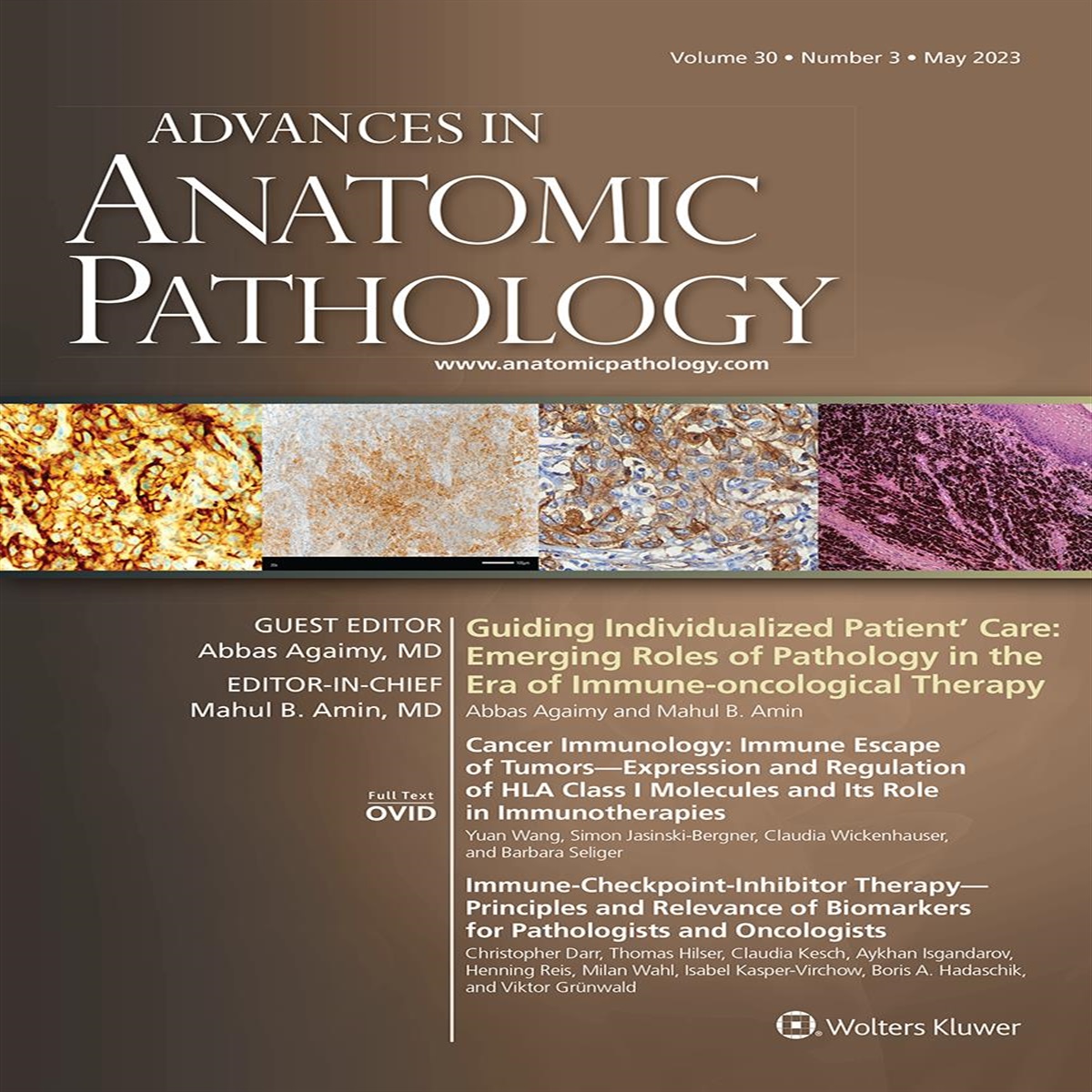 Guiding Individualized Patient’ Care: Emerging Roles of Pathology in the Era of Immune-oncological Therapy
