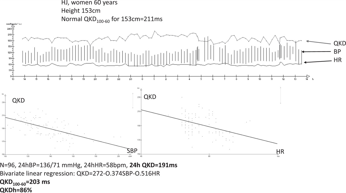 How to measure arterial stiffness independently of blood pressure: the QKD method