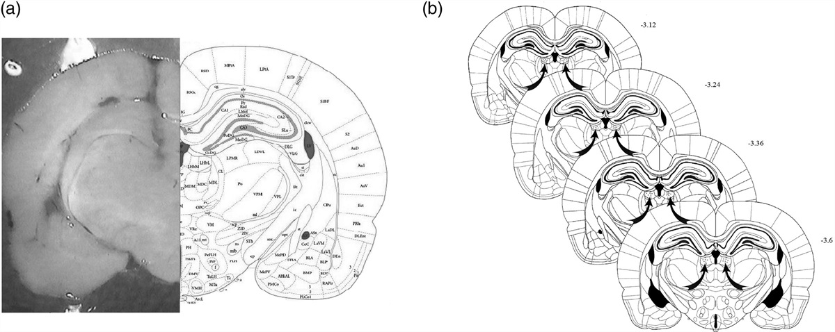 The role of lateral habenula NMDA receptors in tramadol-induced conditioning
