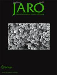 Frequency Following Responses to Tone Glides: Effects of Age and Hearing Loss