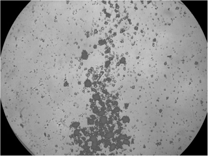 Correction: Targeting IL-3Rα on tumor-derived endothelial cells blunts metastatic spread of triple-negative breast cancer via extracellular vesicle reprogramming
