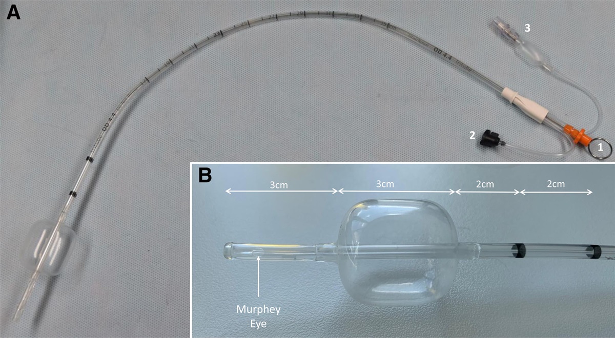 The Tritube: Facilitating Upper Airway Surgery With an Ultrathin Cuffed Airway Device