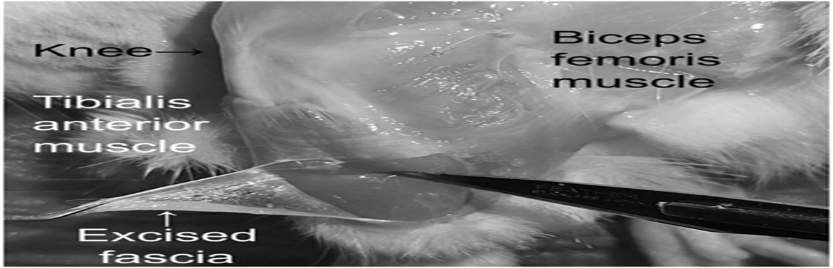 Decreased expression of hyaluronan synthase and loss of hyaluronan-rich cells in the anterior tibial fascia of the rat model of chemotherapy-induced peripheral neuropathy