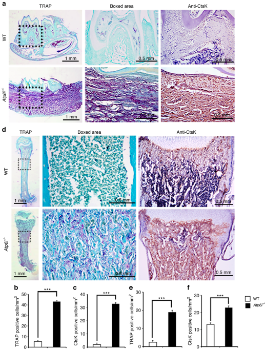Atp6i deficient mouse model uncovers transforming growth factor-β1 /Smad2/3 as a key signaling pathway regulating odontoblast differentiation and tooth root formation