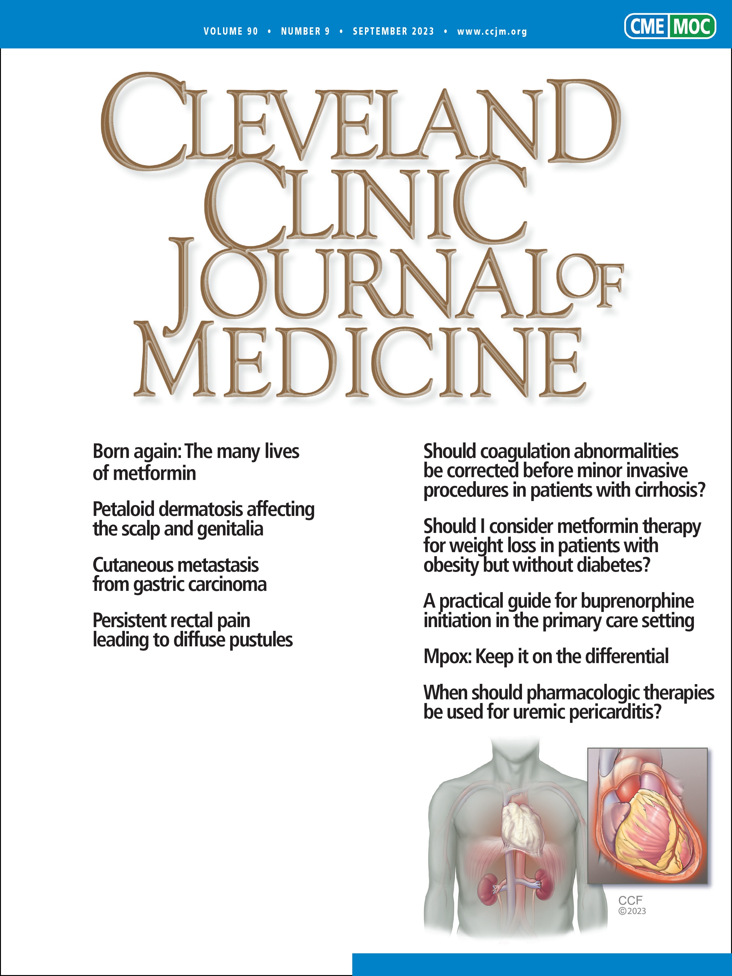 Born again: The many lives of metformin