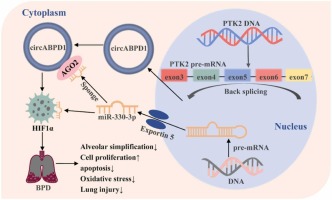 CircABPD1 Alleviates Oxidative Lung Injury of Bronchopulmonary Dysplasia Through Regulating miR-330-3p /HIF1α Axis
