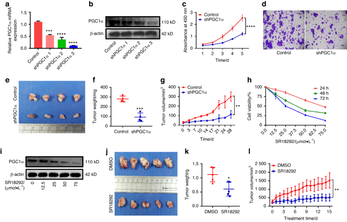Knockdown of PGC1α suppresses dysplastic oral keratinocytes proliferation through reprogramming energy metabolism