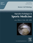 Osteochondritis Dissecans
