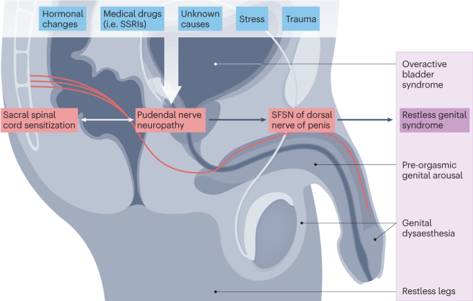 A clinical guide to rare male sexual disorders