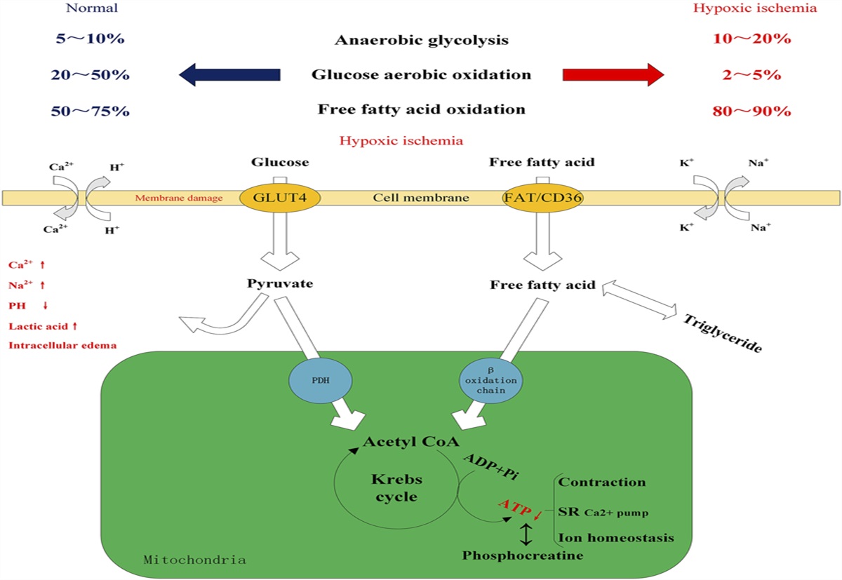 Myocardial Protection by Desflurane: From Basic Mechanisms to Clinical Applications