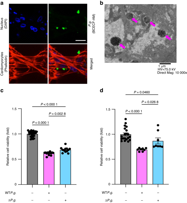 Porphyromonas gingivalis, a periodontal pathogen, impairs post-infarcted myocardium by inhibiting autophagosome–lysosome fusion